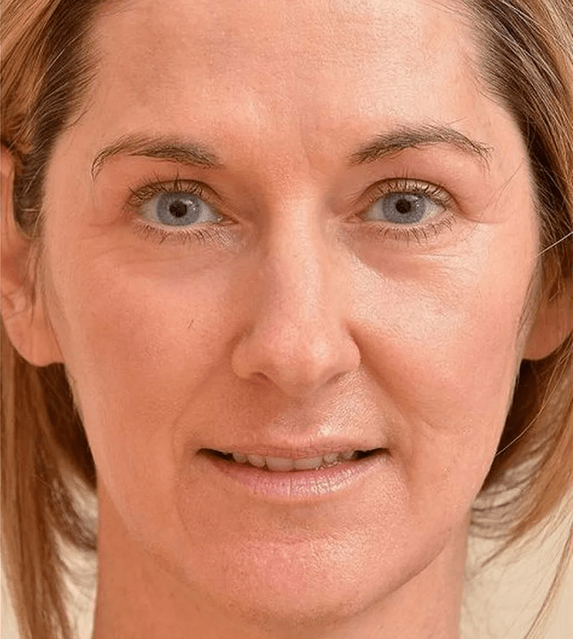 Eudalie krema aplikatu ondoren gazteagoa iruditzen zait