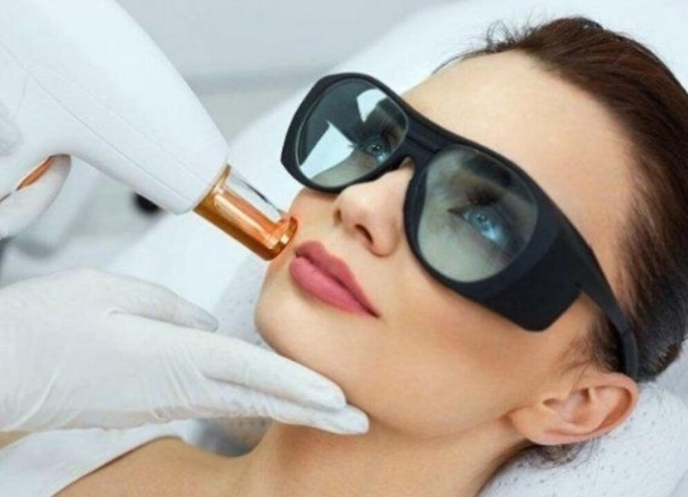 Aurpegiko azalaren azala