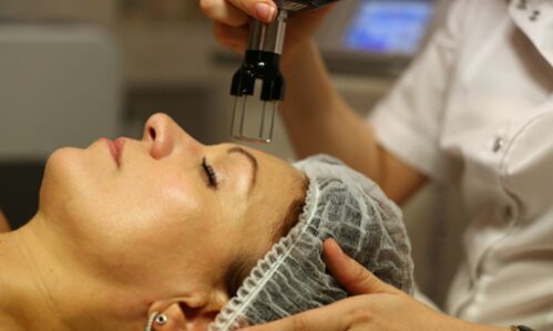 termolisi zatikatua gaztetzeko